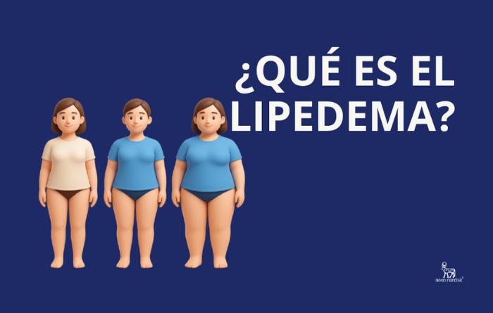 Comparación de dos figuras femeninas: una con piernas y brazos con textura nodular por lipedema, otra con textura de piel por celulitis, texto "Lipedema VS Celulitis - La verdad de su peso"