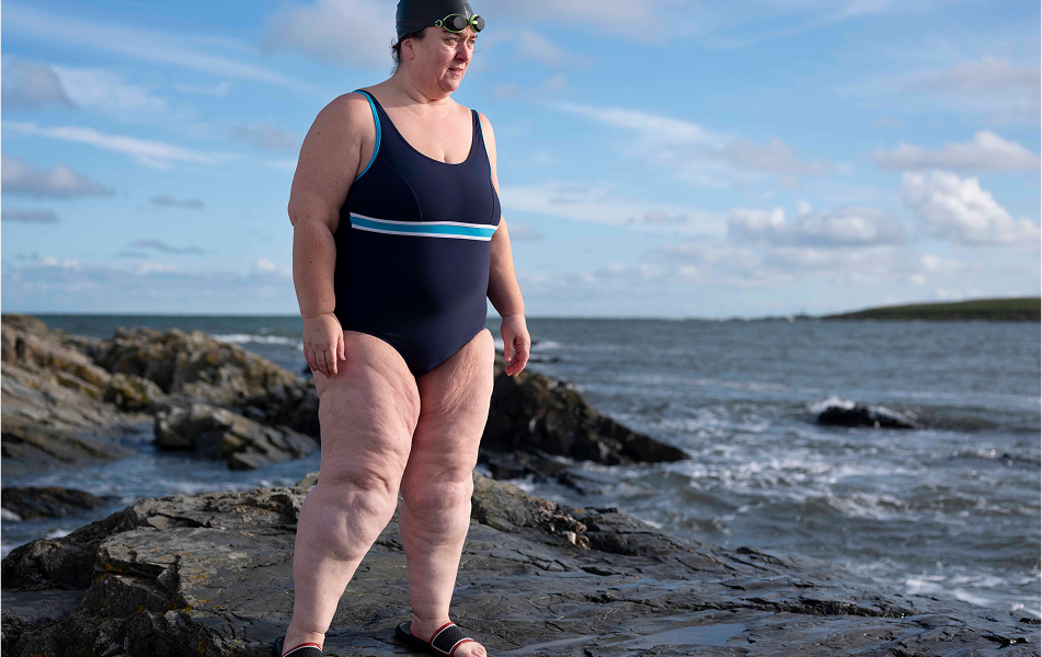  Cómo afecta la obesidad al sistema inmunológico