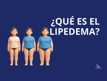 ¿Qué es Lipedema? Tipos, como identificarlos y diferencias con la celulitis 